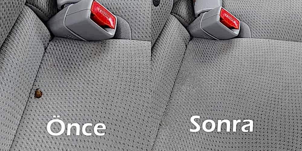 Sigara Yanıklarını Dert Etmeyin